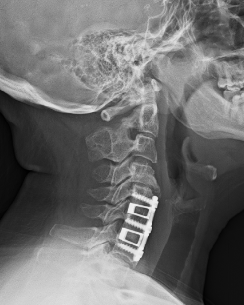 2024 02 Side